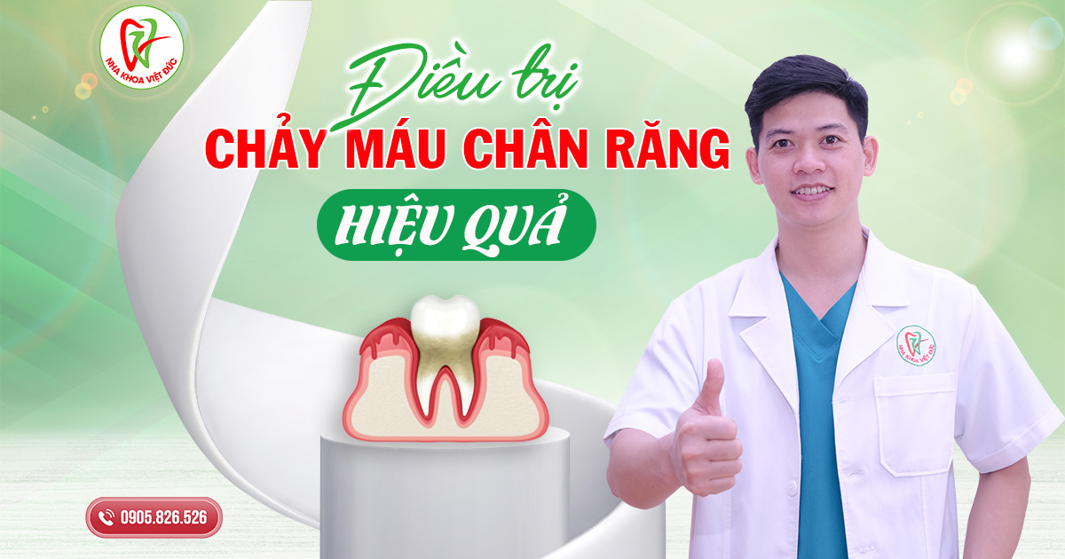 Điều Trị Chảy Máu Chân Răng Hiệu Quả