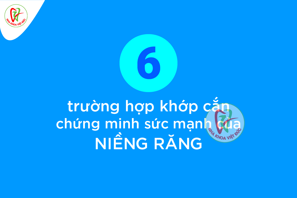 6 TRƯỜNG HỢP KHỚP CẮN CHỨNG MINH SỨC MẠNH CỦA NIỀNG RĂNG