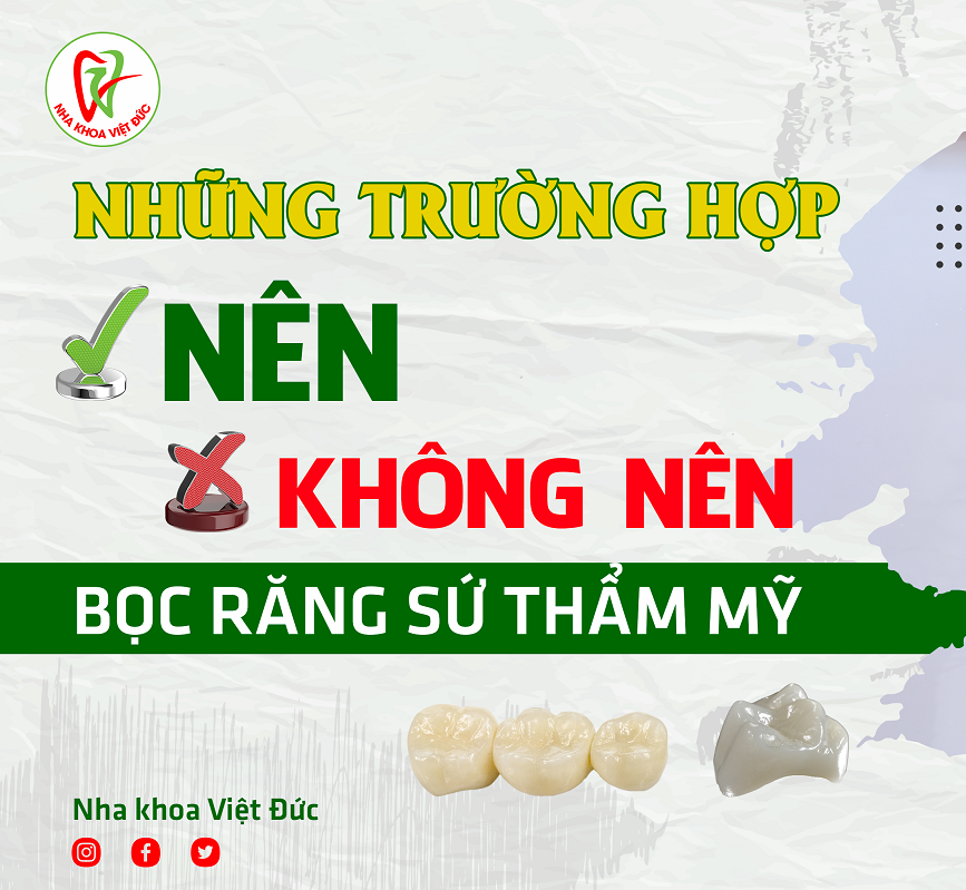 Nên Và Không Nên Bọc Răng Sứ Với Những Trường Hợp Nào