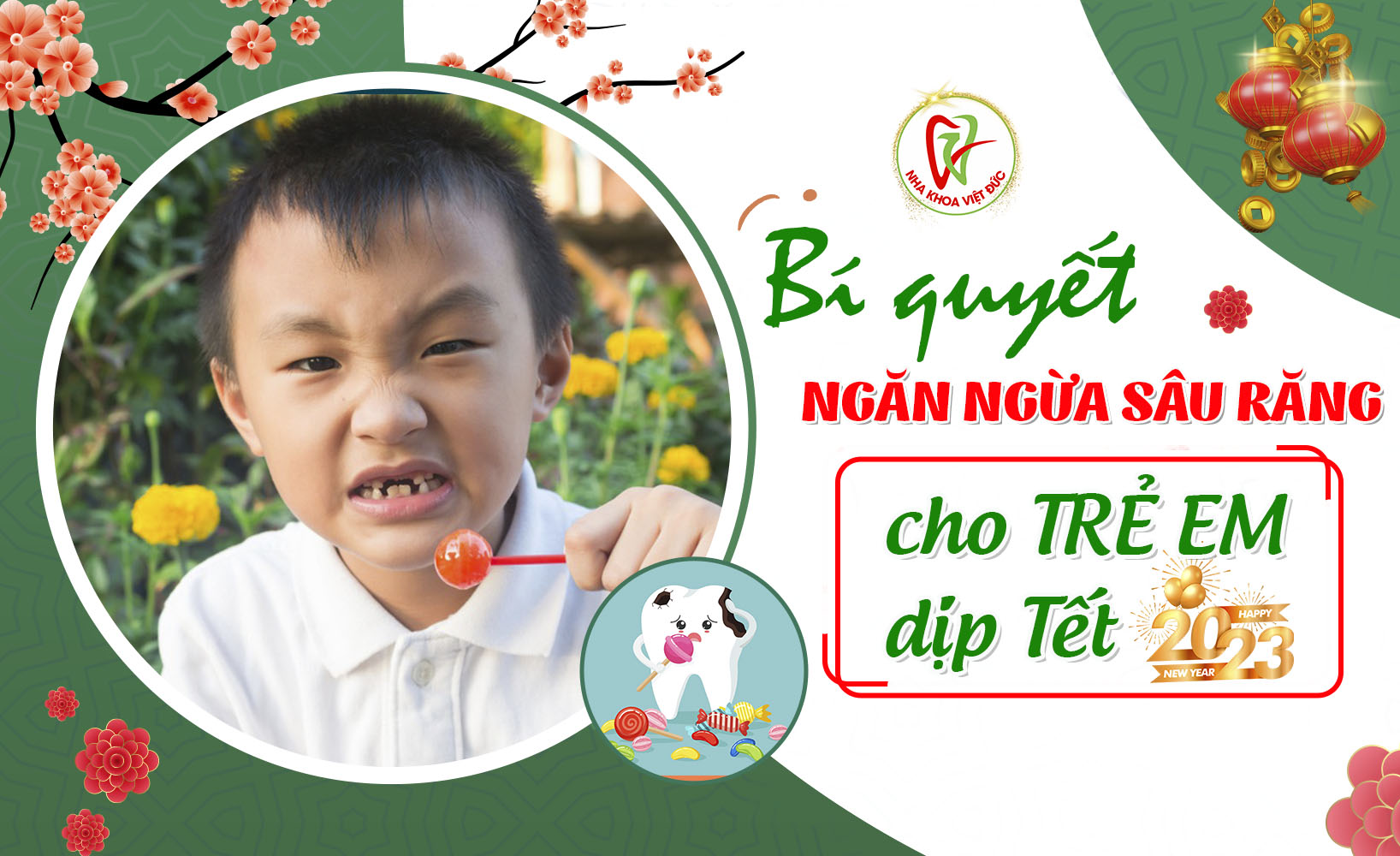 Bí quyết: Ngăn ngừa sâu răng cho trẻ dịp Tết