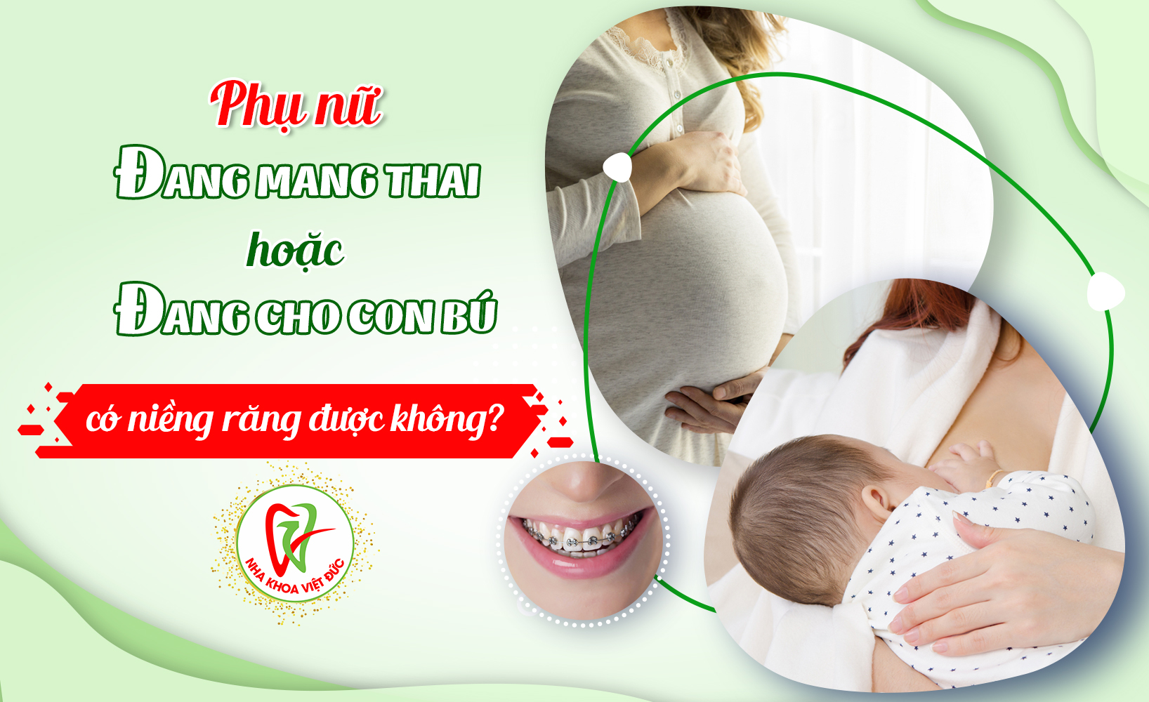 PHỤ NỮ ĐANG MANG THAI HOẶC ĐANG CHO CON BÚ CÓ NIỀNG RĂNG ĐƯỢC KHÔNG?