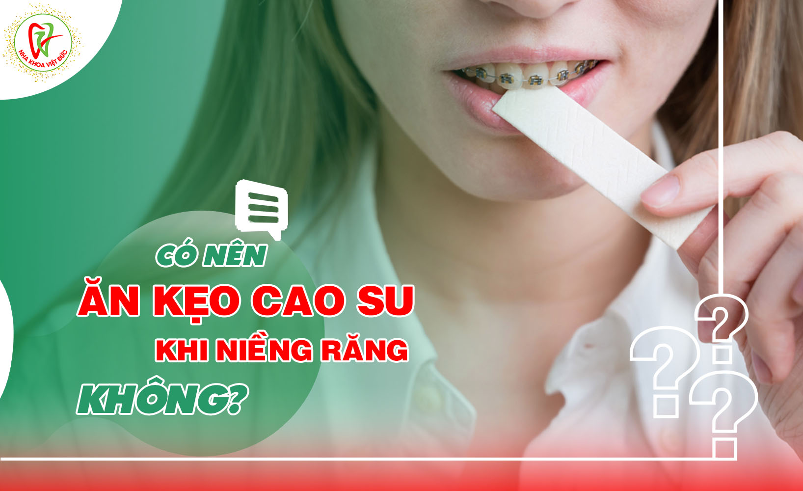 CÓ NÊN ĂN KẸO CAO SU KHI NIỀNG RĂNG KHÔNG?