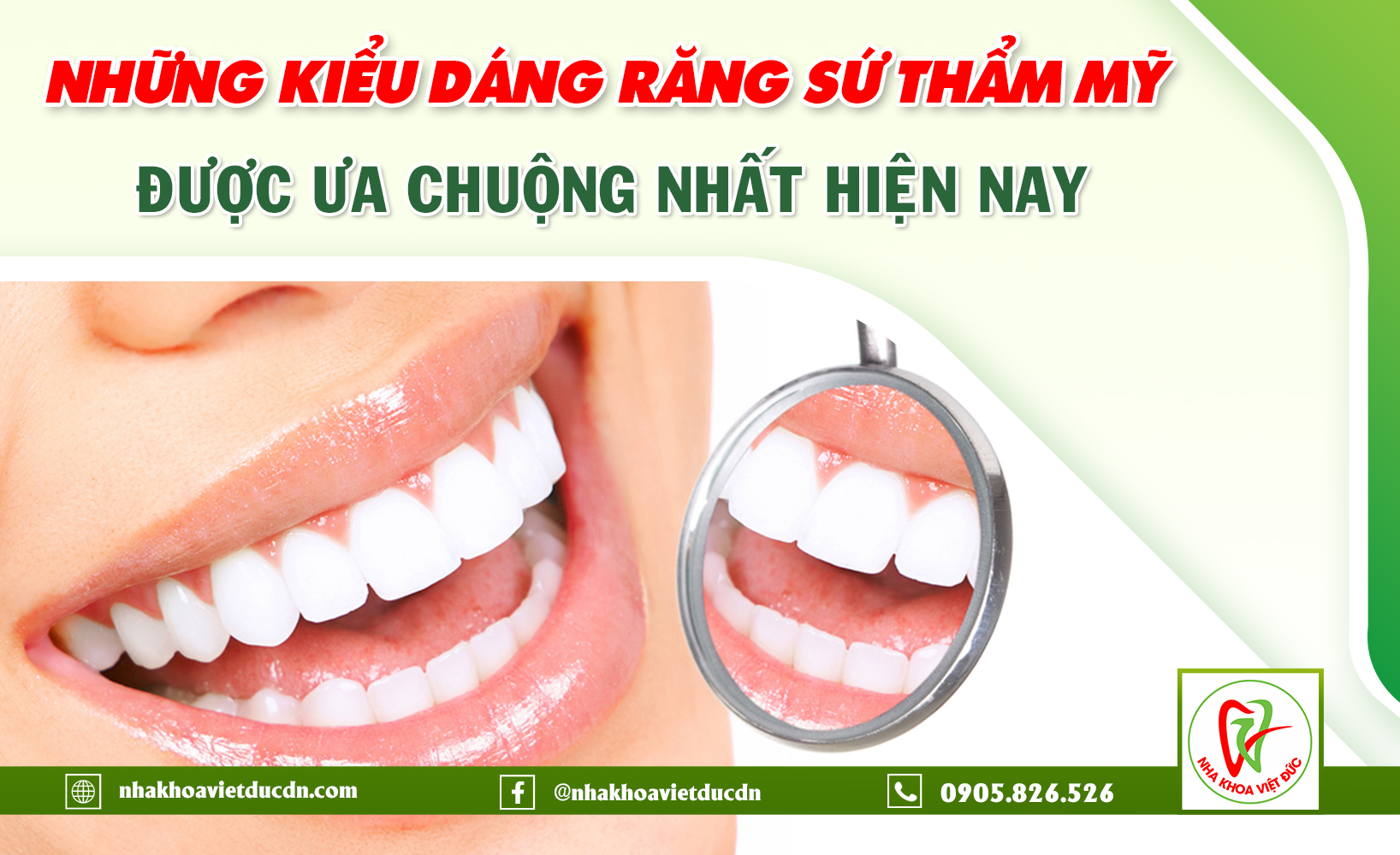 NHỮNG KIỂU DÁNG RĂNG SỨ THẨM MỸ ĐƯỢC ƯA CHUỘNG NHẤT HIỆN NAY