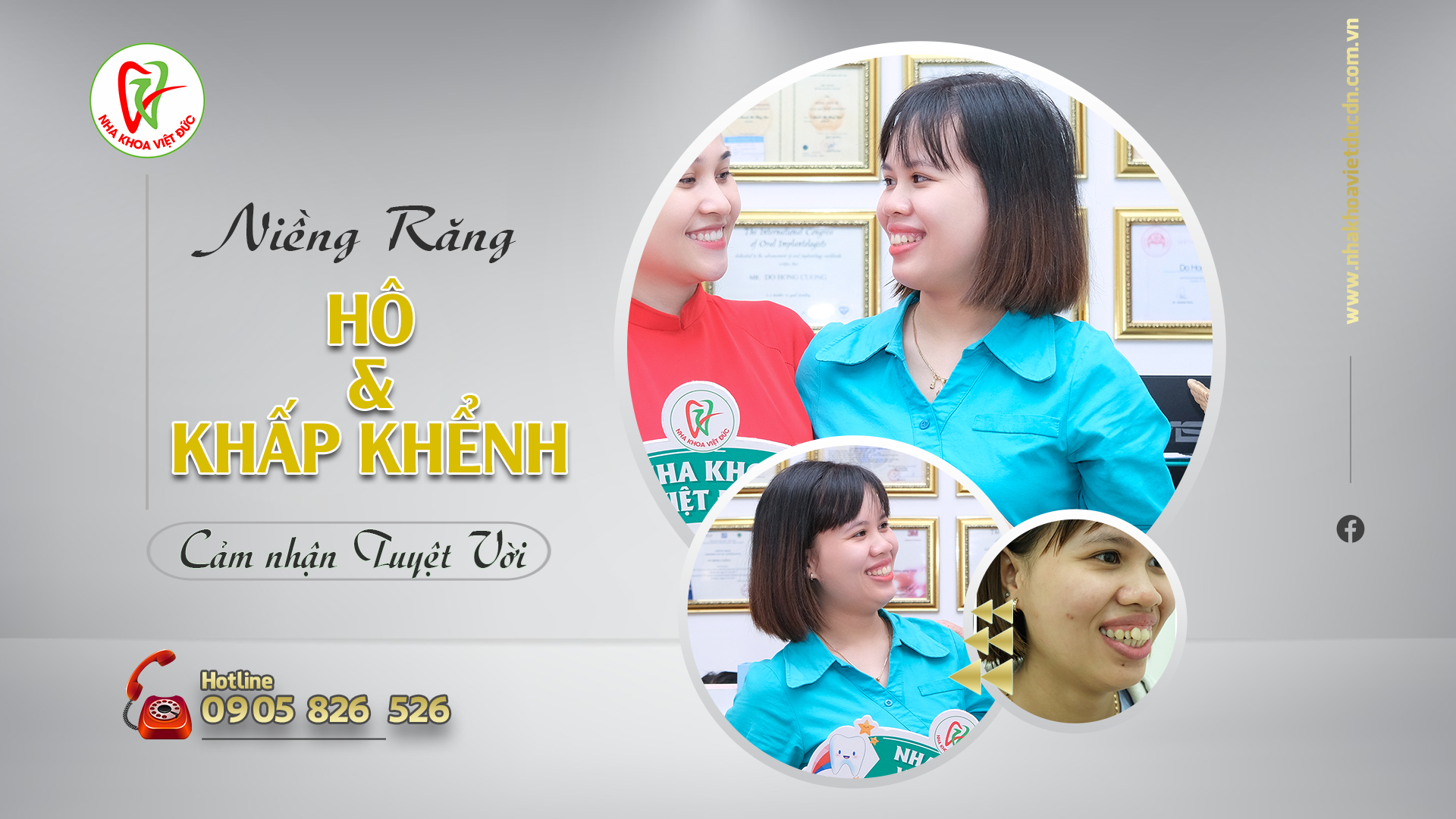 Kết quả niềng răng Hô – Khấp Khểnh